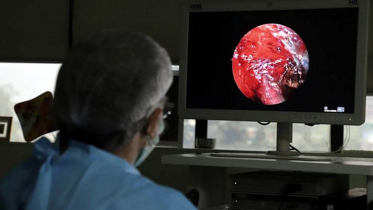 Un doctor indio practica una cirugía endoscópica a una persona que sufre mucormicosis en un hospital en Ghaziabad, la India, el 23 de mayo de 2021. Foto: Ap.