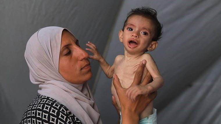 Junio de 2025. Zakariya al-Majdoub, de 11 meses, uno de los niños que sufren de grave desnutrición en Gaza debido al bloqueo israelí. Junio de 2025. Zakariya al-Majdoub, de 11 meses, uno de los niños que sufren de grave desnutrición en Gaza debido al bloqueo israelí.