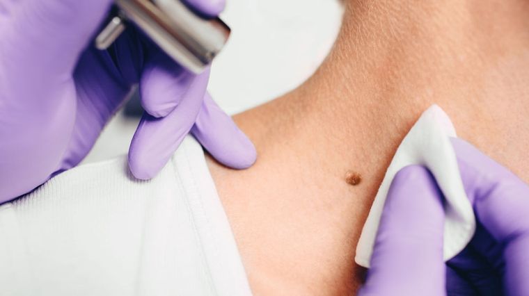 ¡Chau arrugas con esta receta casera!