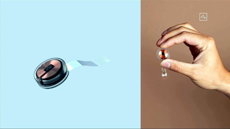 Link, el dispositivo diseñado por Neuralink que conecta el cerebro humano con un computador. Foto: RT