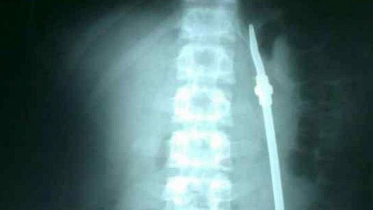 El hombre dio una insólita excusa y luego se tragó una bombilla