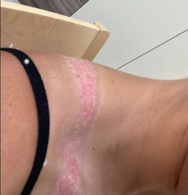 Compró ropa en Shein y sufrió graves consecuencias. Compró ropa en Shein y sufrió graves consecuencias.