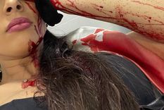 La joven tendrá que someterse a varias cirugías para mejorar el aspecto del rostro