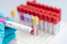 El VIH con un diagnóstico tardío puede tener consecuencias, al igual que otras ITS. El VIH con un diagnóstico tardío puede tener consecuencias, al igual que otras ITS.