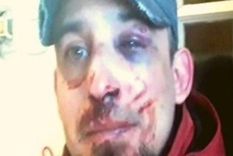 El hombre terminó con fracturas en el tabique, lesiones en un ojo y dientes partidos