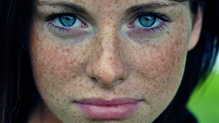 Con esta receta casera, las eliminarás para siempre. Foto: Gentileza