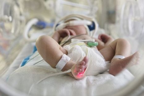 Desde el inicio de la pandemia, 420 bebés han muerto por coronavirus en Brasil, frente a 45 en Estados Unidos. Foto: GETTY IMAGES