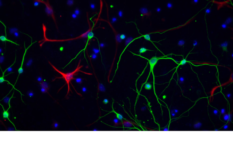 Neuronas y astrocitos: imagen de microscopía de fluorescencia. Foto: CONICET