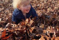 un nino se hizo viral por tener el sindrome del cabello despeinado