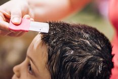 Los piojos pueden convertirse en un grave problema. Foto: iStock