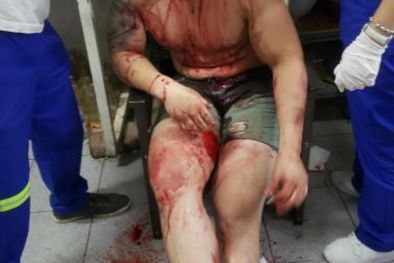 MDZol | Federico al ser atendido por los médicos. Le pusieron 9 puntos en la cabeza