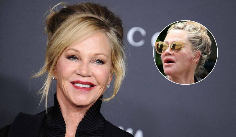 El extraño rostro que mostró Melanie Griffith durante el pasado fin de semana.