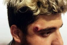 Herida Los médicos le extrajeron la bala y el chico está bien Herida Los médicos le extrajeron la bala y el chico está bien