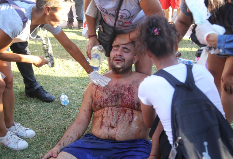 Así terminó el militante herido Foto: Noticias Argentinas