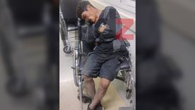 Rodrigo Joel Maturano luego del ser acusado por un robo y recibir una paliza vecinal en Las Heras. Rodrigo Joel Maturano luego del ser acusado por un robo y recibir una paliza vecinal en Las Heras.