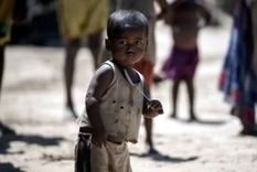 La mala nutrición afecta especialmente a los países con ingresos más bajos. Foto: Efe. La mala nutrición afecta especialmente a los países con ingresos más bajos. Foto: Efe.