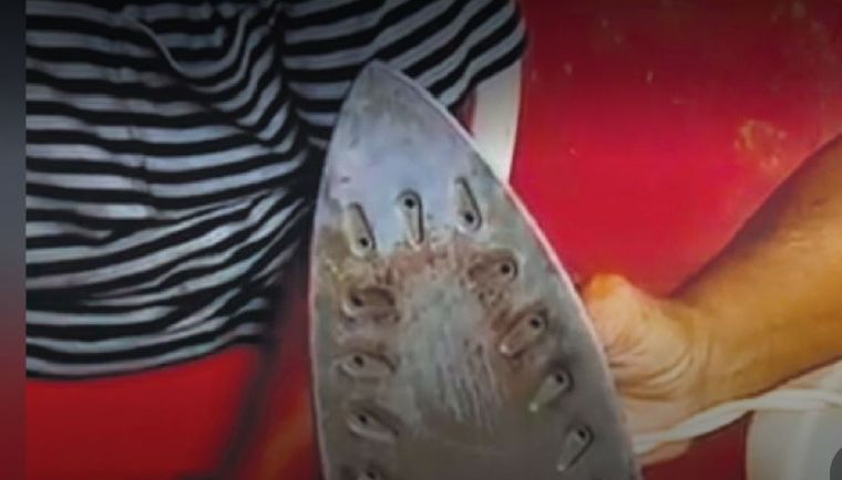 La joven fu golpeada y quemada con una plancha en la cara por querer dejar a su novio