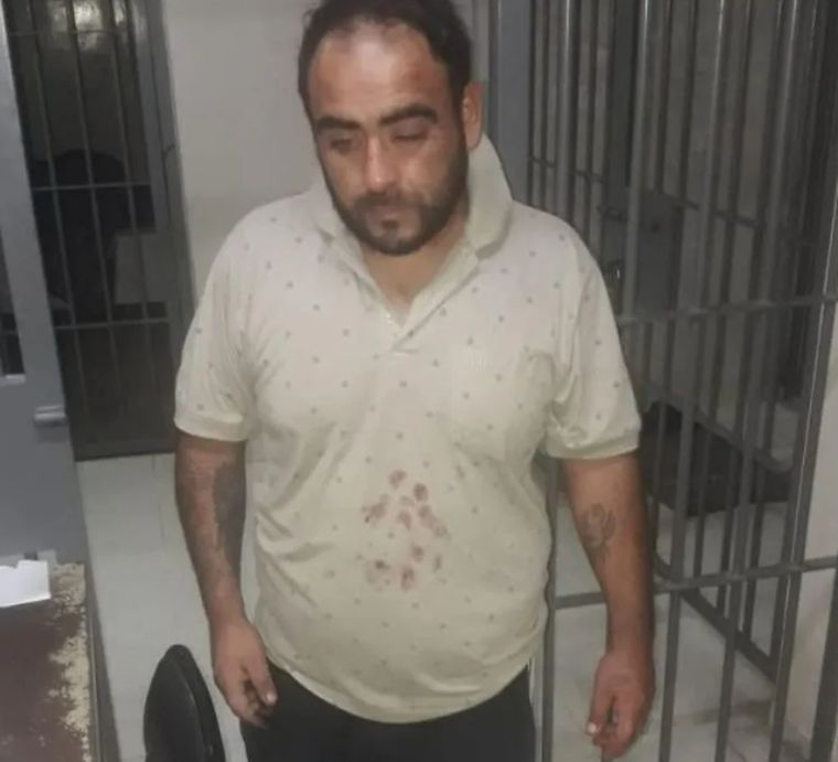 Sangre El hombre dejó de agredir a su pareja porque intervinieron los vecinos.