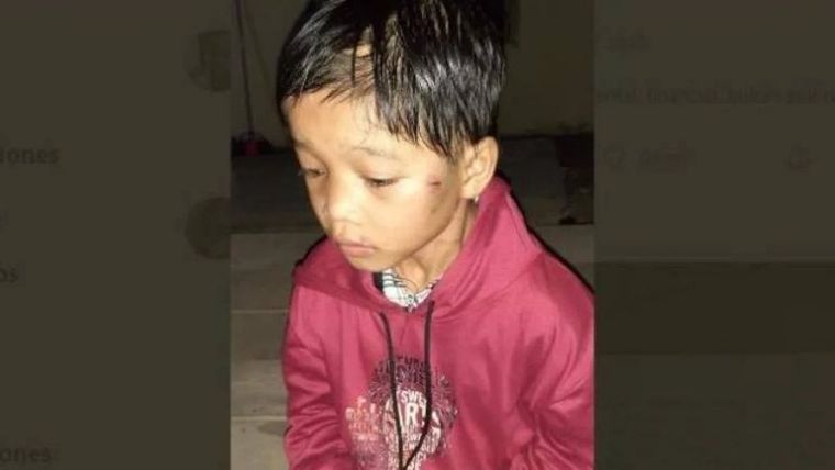 El nene fue abandonado por su madre porque el padre le pegaba salvajemente cada vez que el niño hacía una travesura