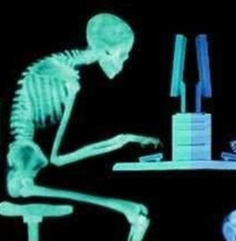 Postura encorvada por exceso de pantallas. Postura encorvada por exceso de pantallas.