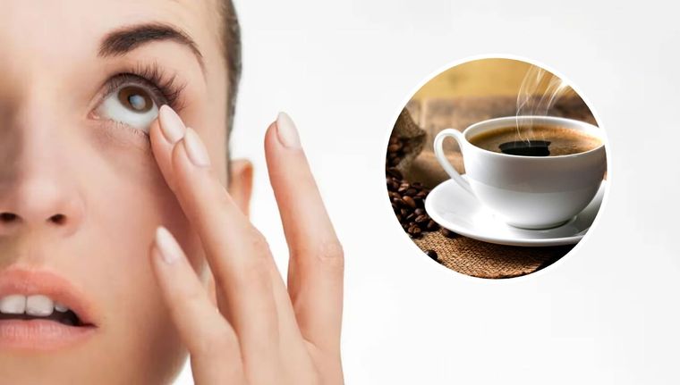 El tip del café para eliminar las ojeras (Shutterstock).
