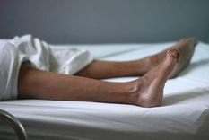 La enfermedad de Guillain-Barré suele tener entre sus primeros síntomas un hormigueo en los pies Foto: Getty Images