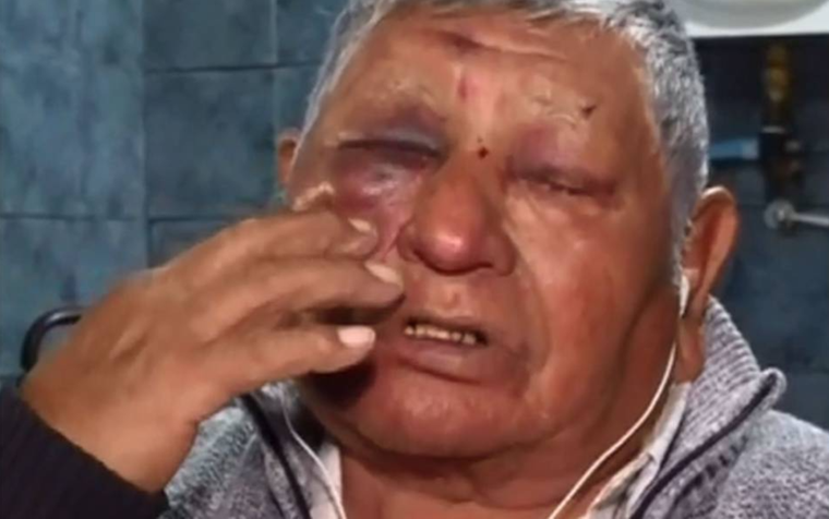 Luego del violento ataque al jubilado y tras presentar pruebas, el agresor quedó en libertad.