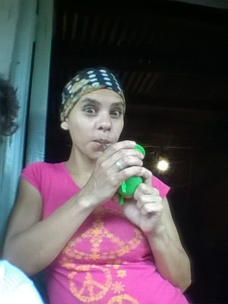 Estela fue atacada por su pareja, en otro de los tantos casos de violencia doméstica que se registran en Argentina