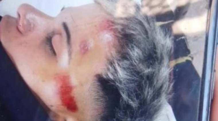 Joven inconsciente tras la brutal pelea Foto: NA
