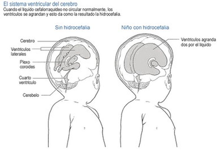 Un misterio menos en la medicina.
