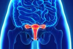 La endometriosis es una enfermedad inflamatoria crónica.