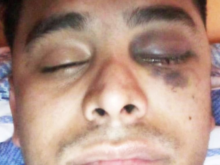 Así quedó el hombre tras el ataque Foto: Gentileza
