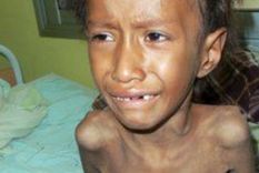 murio nestor femenia, el nino qom afectado de tuberculosis y desnutricion