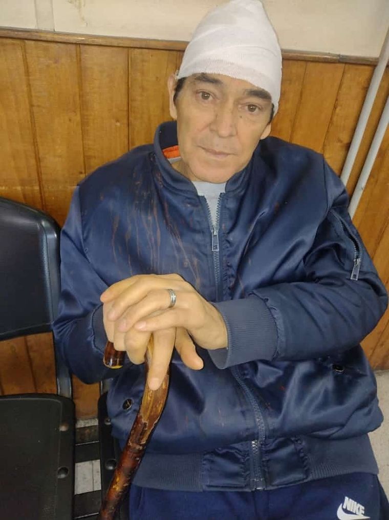 Así quedó el jubilado tras el violento hecho de inseguridad Foto: Gentileza vecinos de San José