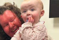 Georgina Burrough que nació con una condición de la piel extremadamente rara ya ha dado a luz a dos hijas sin pasarles su condición. Foto: BBC Mundo