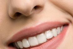 5 alimentos que manchan los dientes y seguro no sabías Te explicamos qué alimentos podrían manchar tu dentadura. Foto: Pexels