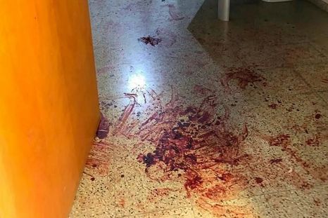 Las imágenes del macabro hallazgo Foto: El Doce