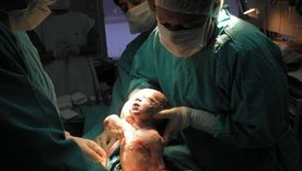 Los partos por cesárea han crecido considerablemente en todo el mundo y Mendoza no es la excepción. Los partos por cesárea han crecido considerablemente en todo el mundo y Mendoza no es la excepción.