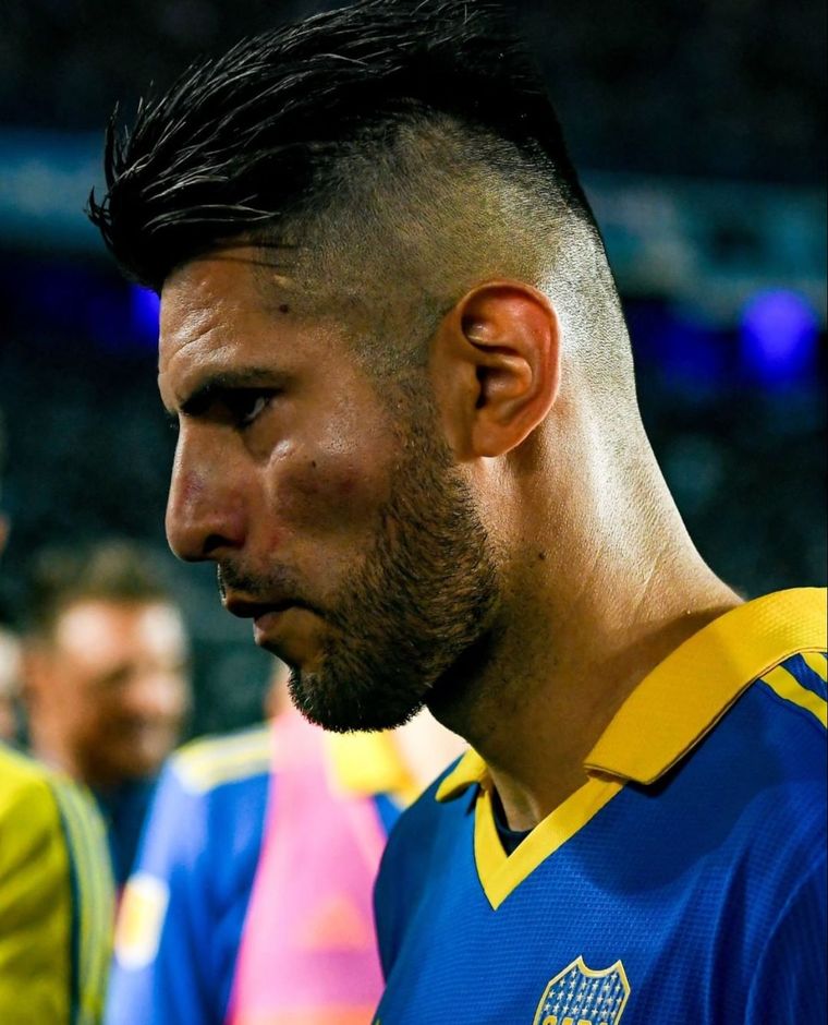 El pómulo hinchado de Zambrano y la versión oficial de Boca.
