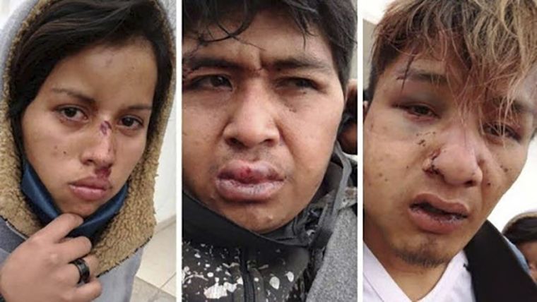 Golpeados Así quedaron los rostros de algunos de los aborígenes. Imagen: Télam.