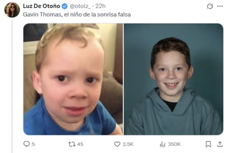 "El niño de la sonrisa falsa" que se hizo viral en redes sociales. Foto: X "El niño de la sonrisa falsa" que se hizo viral en redes sociales. Foto: X