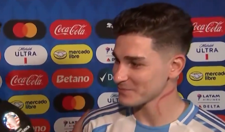 El delantero se retiró del campo con una impactante marca. Foto: Captura