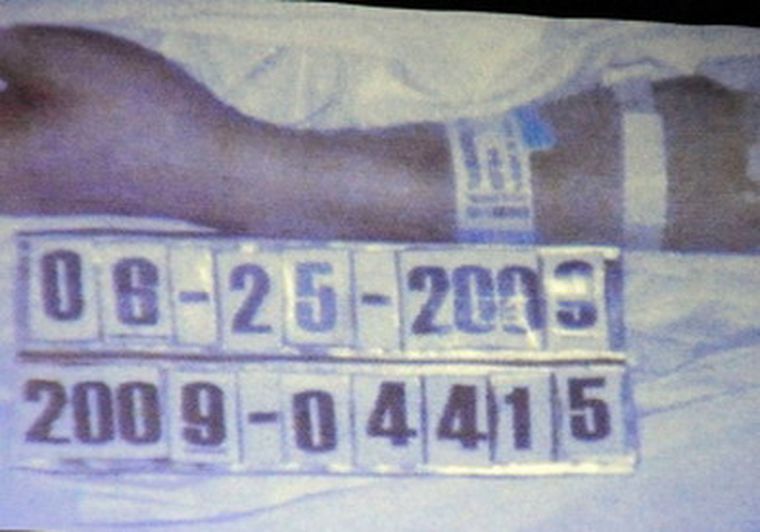 Una de las fotos de la autopsia.