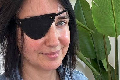 MDZol | Lucy Owen con un parche en el ojo.