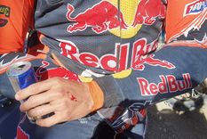 Así quedó la mano del argentino. (Foto Diego Durruty) Así quedó la mano del argentino. (Foto Diego Durruty)