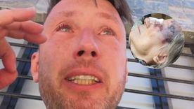 El dolor del influencer Pablo Pizzurno. El dolor del influencer Pablo Pizzurno.