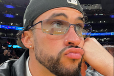 Bad Bunny en SNL: lanza indirectas a Kendall Jenner y recibe una bofeteada de Mick Jagger Bad Bunny es un artista de Puerto Rico. Foto: Instagram