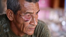 El impacto del misil lanzó a Wilman González contra la pared. Su tía, Rosa, perdió la vida.