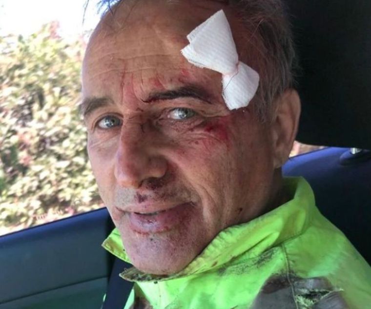 Baldassi recalcó la importancia del uso de equipamiento de seguridad a la hora de practicar deportes como el ciclismo.