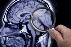 Identifican por primera vez alteraciones estructurales en los llamados “Supercomplejos mitocondriales” que podrían estar asociadas al daño cerebral que provoca la Enfermedad de Alzheimer (EA).